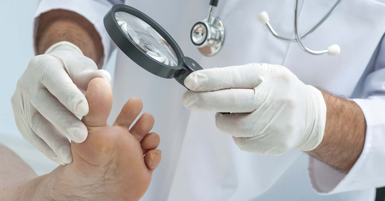 doctor examines feet for nail fungus