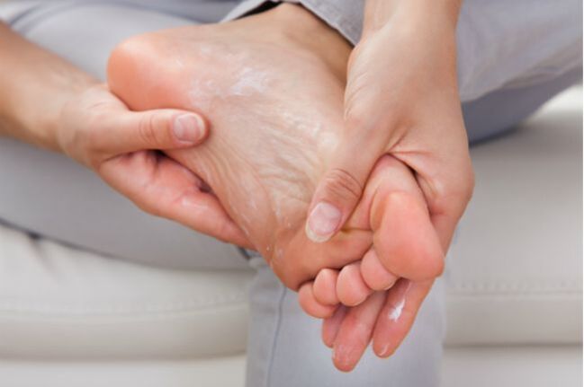 Antifungal creams and drops will help in the initial stage of toenail fungus