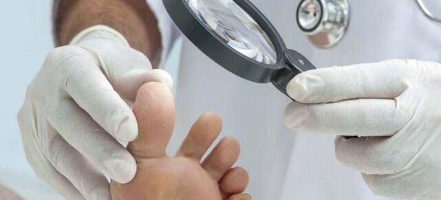 Examinations before starting treatment for fungus