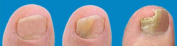 Fungal development process