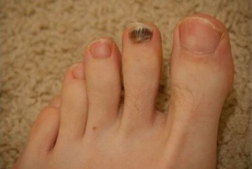 Use of oral and topical medications