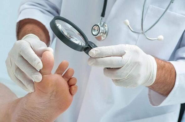 toenail fungus causes and treatment